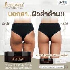 Jcrown เจคราว สครับผิวขาว ครีมขัดขี้ไคลตัว ครีมสครับจ้ะ อาร์สยาม 9